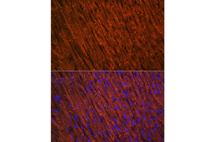 Immunofluorescence - Anti-Desmin Antibody [ARC0235] (A305689) - Antibodies.com
