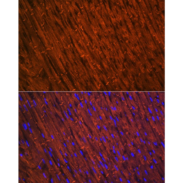Immunofluorescence - Anti-Desmin Antibody [ARC0235] (A305689) - Antibodies.com