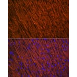 Immunofluorescence - Anti-Desmin Antibody [ARC0235] (A305689) - Antibodies.com