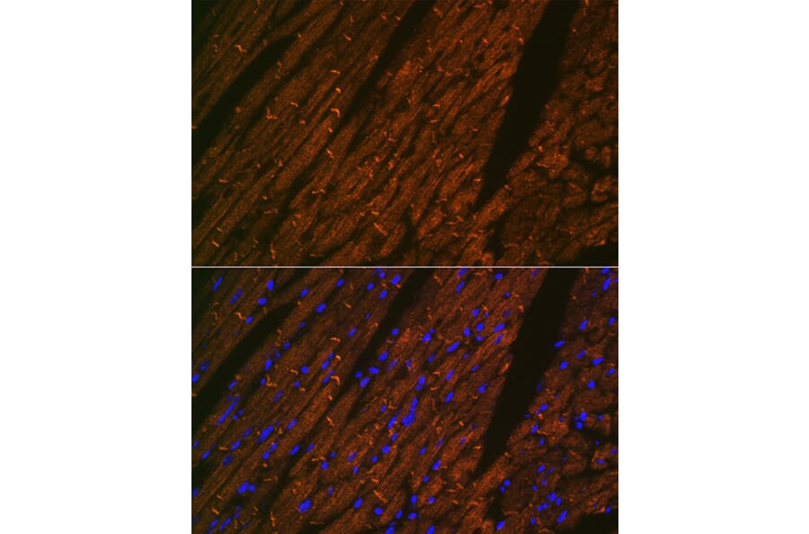 Immunofluorescence - Anti-Desmin Antibody [ARC0235] (A305689) - Antibodies.com