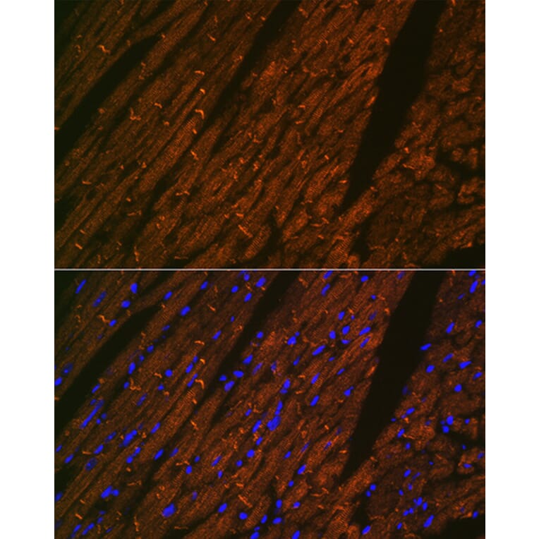 Immunofluorescence - Anti-Desmin Antibody [ARC0235] (A305689) - Antibodies.com