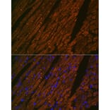 Immunofluorescence - Anti-Desmin Antibody [ARC0235] (A305689) - Antibodies.com