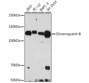 Western Blot - Anti-Chromogranin B Antibody [ARC2023] (A305690) - Antibodies.com