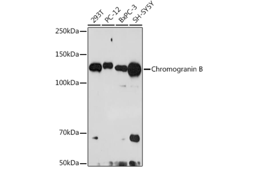 Western Blot - Anti-Chromogranin B Antibody [ARC2023] (A305690) - Antibodies.com