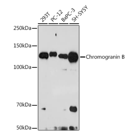 Western Blot - Anti-Chromogranin B Antibody [ARC2023] (A305690) - Antibodies.com