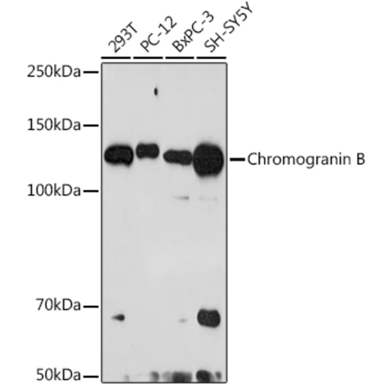 Western Blot - Anti-Chromogranin B Antibody [ARC2023] (A305690) - Antibodies.com