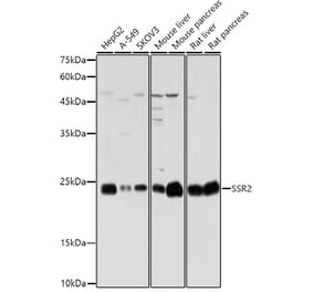 Western Blot - Anti-SSR2 Antibody (A305691) - Antibodies.com