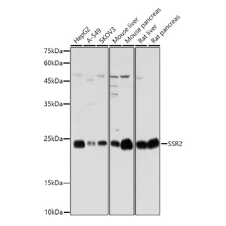 Western Blot - Anti-SSR2 Antibody (A305691) - Antibodies.com