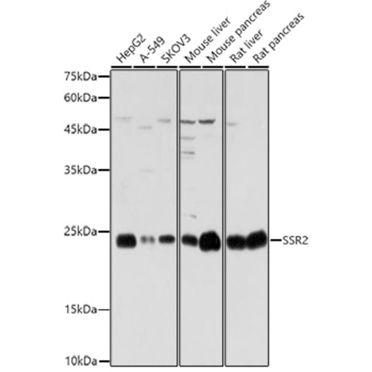 Western Blot - Anti-SSR2 Antibody (A305691) - Antibodies.com