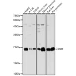 Western Blot - Anti-SSR2 Antibody (A305691) - Antibodies.com