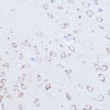 Immunohistochemistry - Anti-SSR2 Antibody (A305691) - Antibodies.com