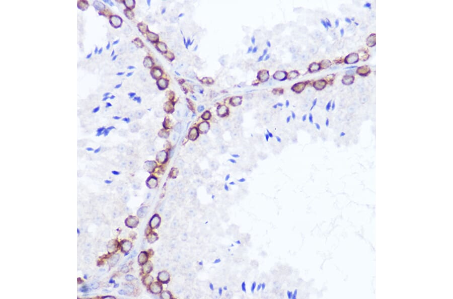 Immunohistochemistry - Anti-SSR2 Antibody (A305691) - Antibodies.com
