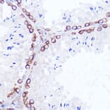 Immunohistochemistry - Anti-SSR2 Antibody (A305691) - Antibodies.com