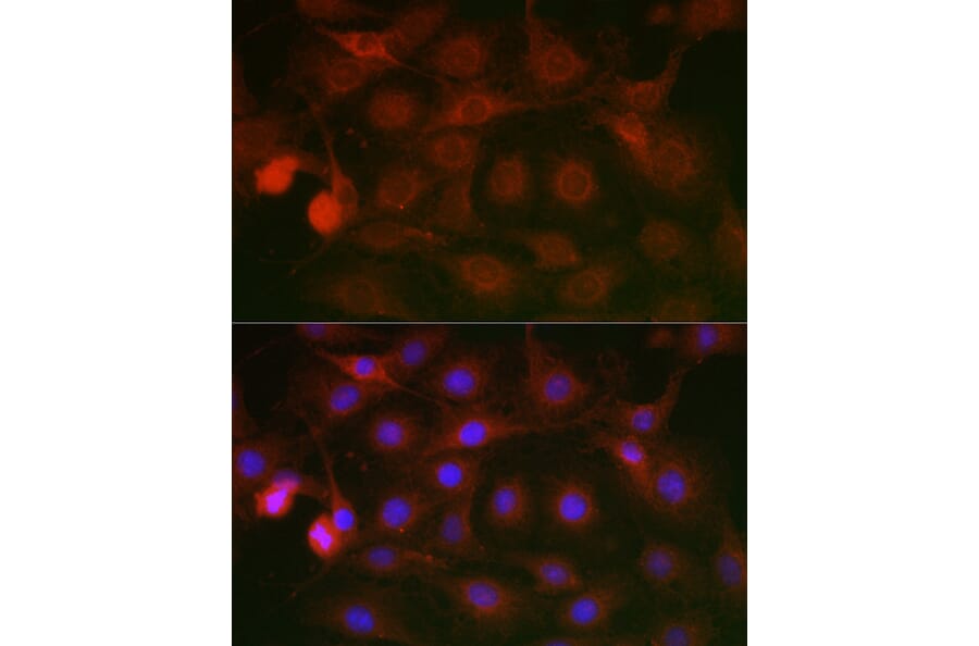 Immunofluorescence - Anti-SSR2 Antibody (A305691) - Antibodies.com