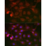 Immunofluorescence - Anti-SSR2 Antibody (A305691) - Antibodies.com
