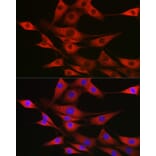 Immunofluorescence - Anti-SSR2 Antibody (A305691) - Antibodies.com