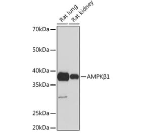 Western Blot - Anti-AMPK beta 1 Antibody [ARC1061] (A305692) - Antibodies.com