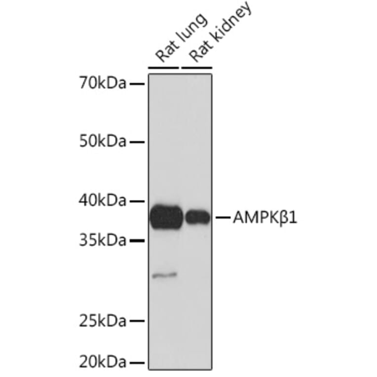 Western Blot - Anti-AMPK beta 1 Antibody [ARC1061] (A305692) - Antibodies.com