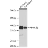 Western Blot - Anti-AMPK beta 1 Antibody [ARC1061] (A305692) - Antibodies.com