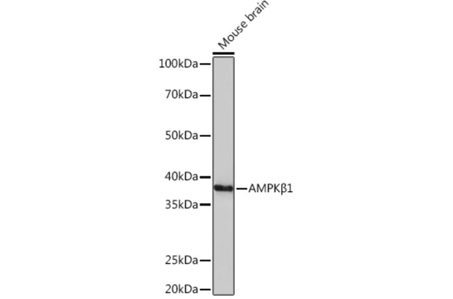 Western Blot - Anti-AMPK beta 1 Antibody [ARC1061] (A305692) - Antibodies.com