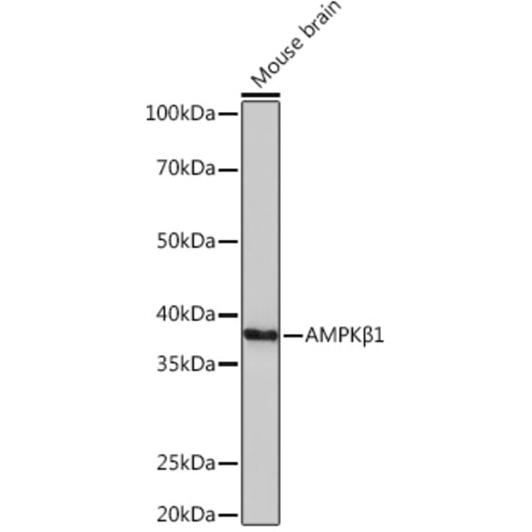 Western Blot - Anti-AMPK beta 1 Antibody [ARC1061] (A305692) - Antibodies.com