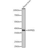 Western Blot - Anti-AMPK beta 1 Antibody [ARC1061] (A305692) - Antibodies.com