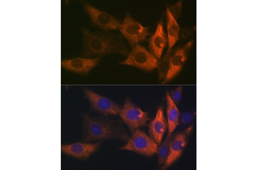 Immunofluorescence - Anti-AMPK beta 1 Antibody [ARC1061] (A305692) - Antibodies.com
