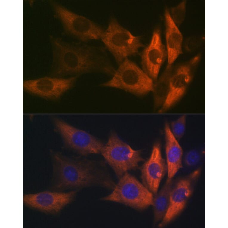 Immunofluorescence - Anti-AMPK beta 1 Antibody [ARC1061] (A305692) - Antibodies.com