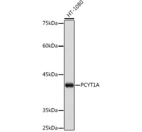 Western Blot - Anti-CT A Antibody [ARC2098] (A305693) - Antibodies.com