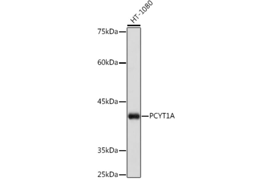 Western Blot - Anti-CT A Antibody [ARC2098] (A305693) - Antibodies.com