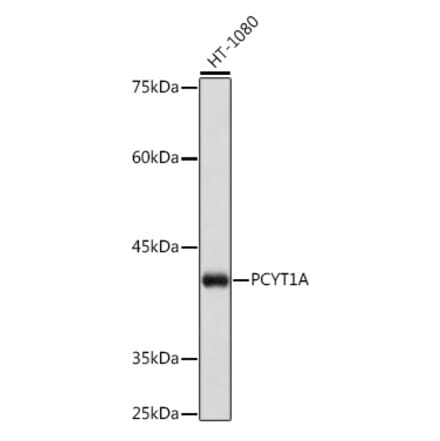 Western Blot - Anti-CT A Antibody [ARC2098] (A305693) - Antibodies.com