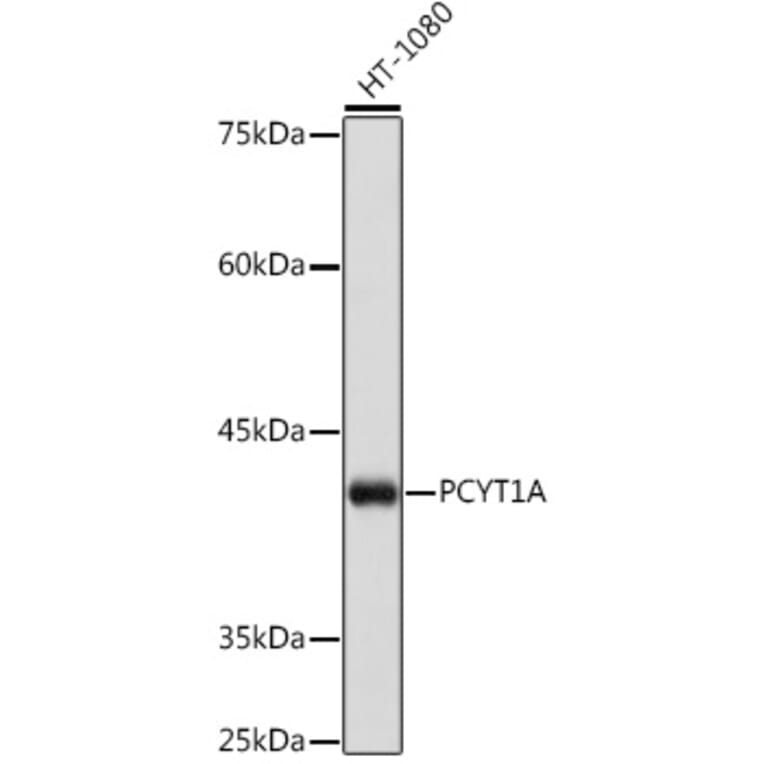 Western Blot - Anti-CT A Antibody [ARC2098] (A305693) - Antibodies.com