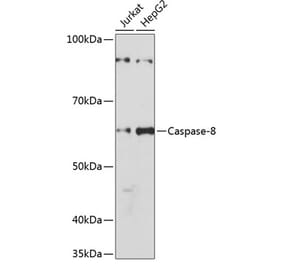 Western Blot - Anti-Caspase-8 Antibody [ARC0028] (A305694) - Antibodies.com