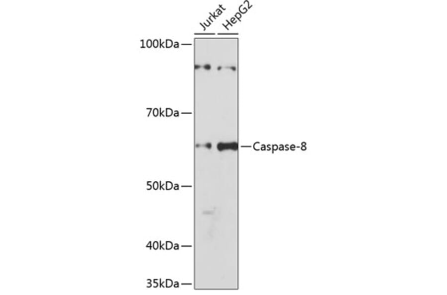 Western Blot - Anti-Caspase-8 Antibody [ARC0028] (A305694) - Antibodies.com