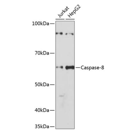 Western Blot - Anti-Caspase-8 Antibody [ARC0028] (A305694) - Antibodies.com