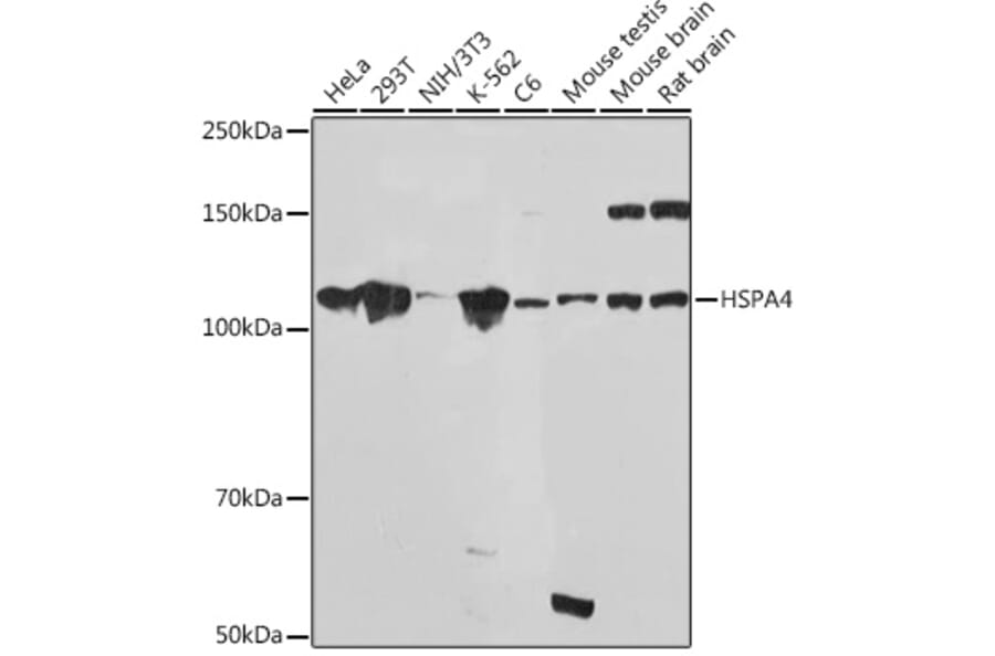 Western Blot - Anti-HSPA4 Antibody [ARC2237] (A305695) - Antibodies.com