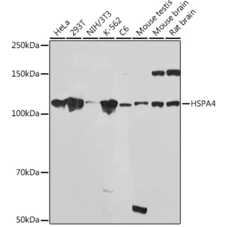 Western Blot - Anti-HSPA4 Antibody [ARC2237] (A305695) - Antibodies.com