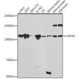Western Blot - Anti-HSPA4 Antibody [ARC2237] (A305695) - Antibodies.com