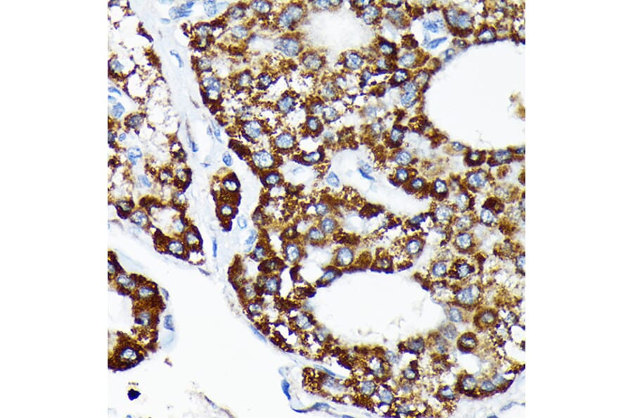 Immunohistochemistry - Anti-HSPA4 Antibody [ARC2237] (A305695) - Antibodies.com