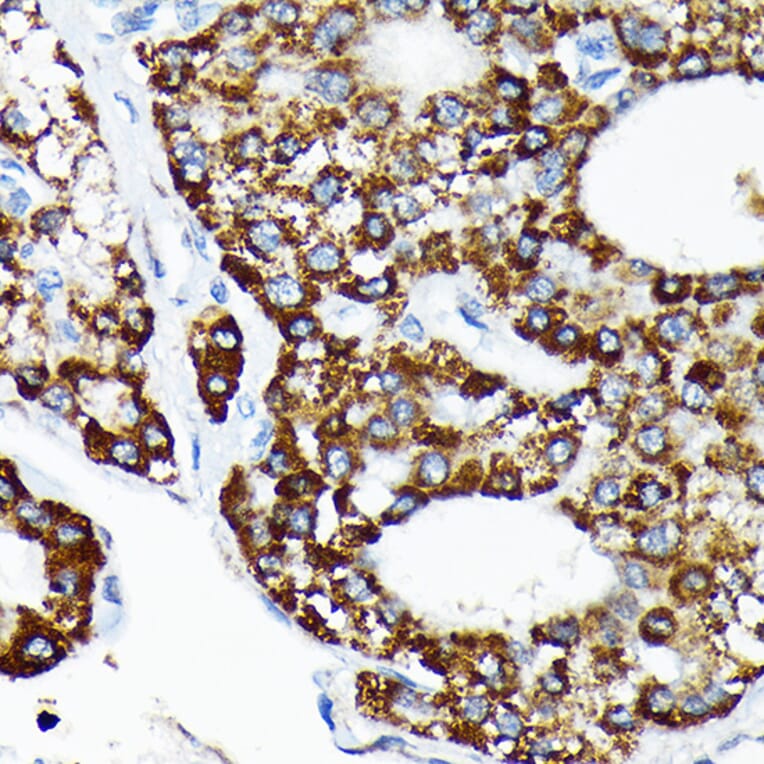 Immunohistochemistry - Anti-HSPA4 Antibody [ARC2237] (A305695) - Antibodies.com