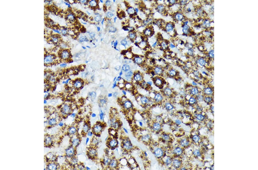 Immunohistochemistry - Anti-HSPA4 Antibody [ARC2237] (A305695) - Antibodies.com