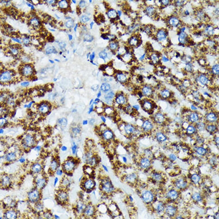 Immunohistochemistry - Anti-HSPA4 Antibody [ARC2237] (A305695) - Antibodies.com