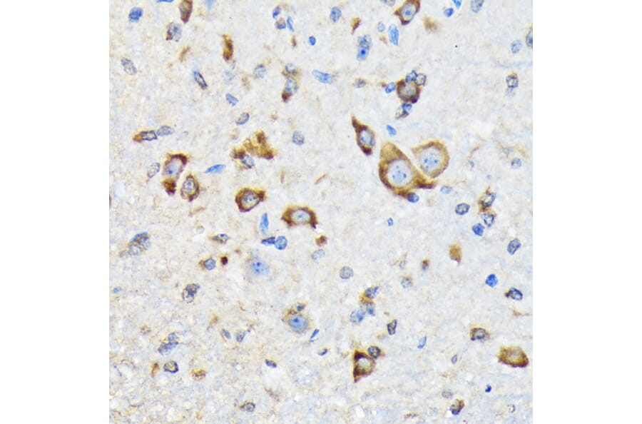 Immunohistochemistry - Anti-HSPA4 Antibody [ARC2237] (A305695) - Antibodies.com