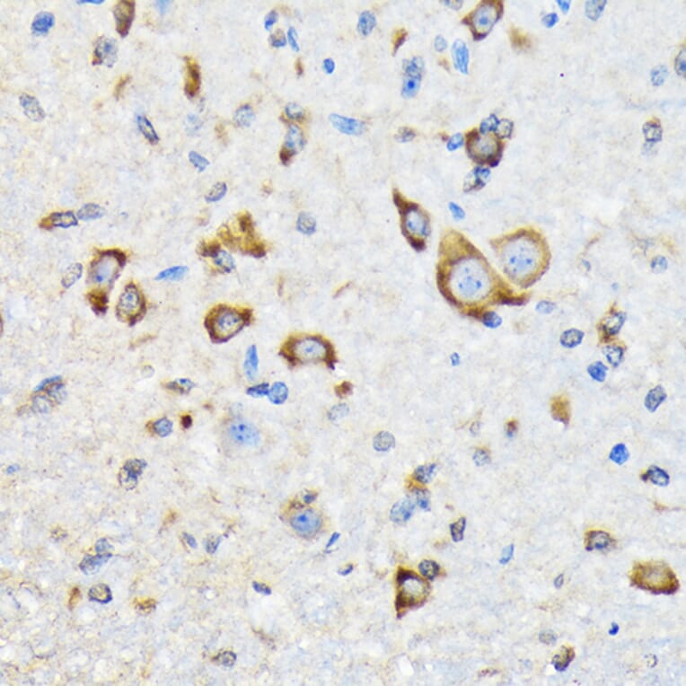 Immunohistochemistry - Anti-HSPA4 Antibody [ARC2237] (A305695) - Antibodies.com
