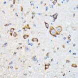 Immunohistochemistry - Anti-HSPA4 Antibody [ARC2237] (A305695) - Antibodies.com