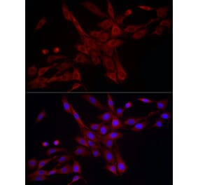 Immunofluorescence - Anti-DRP1 Antibody (A305696) - Antibodies.com