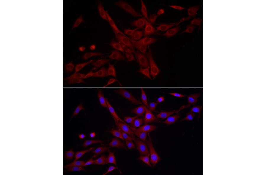 Immunofluorescence - Anti-DRP1 Antibody (A305696) - Antibodies.com