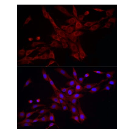 Immunofluorescence - Anti-DRP1 Antibody (A305696) - Antibodies.com