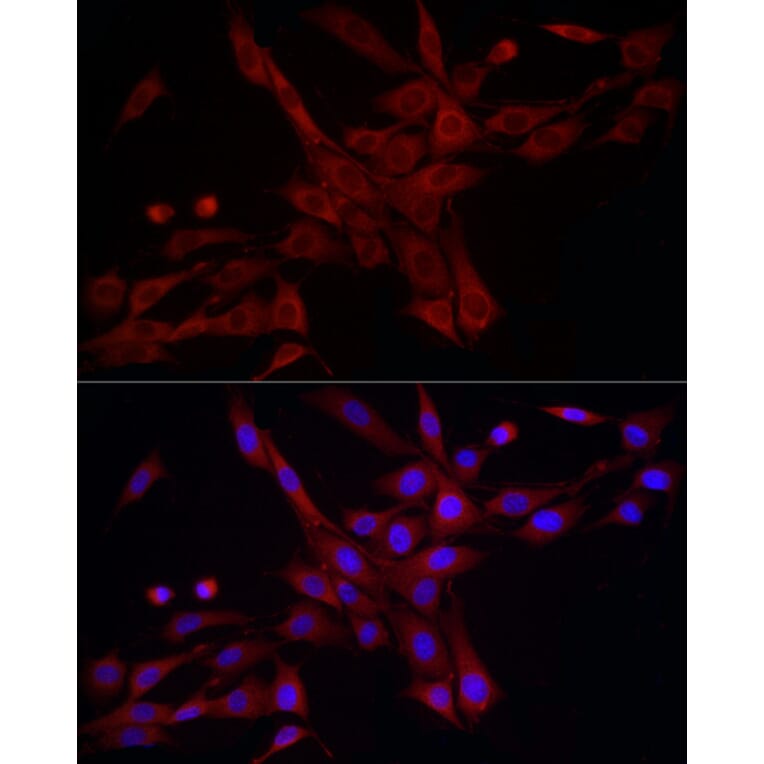 Immunofluorescence - Anti-DRP1 Antibody (A305696) - Antibodies.com