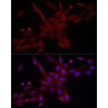 Immunofluorescence - Anti-DRP1 Antibody (A305696) - Antibodies.com